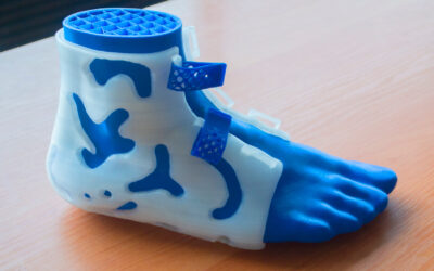 3D Printing in Healthcare